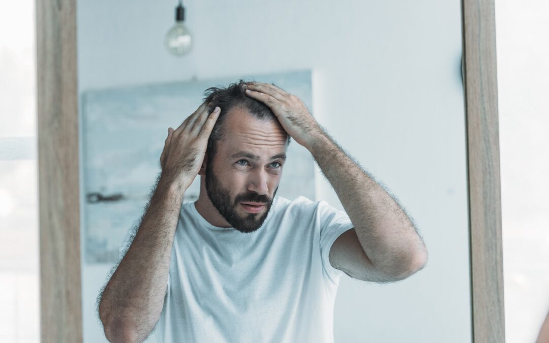 5 Ways to Prevent Hair Loss