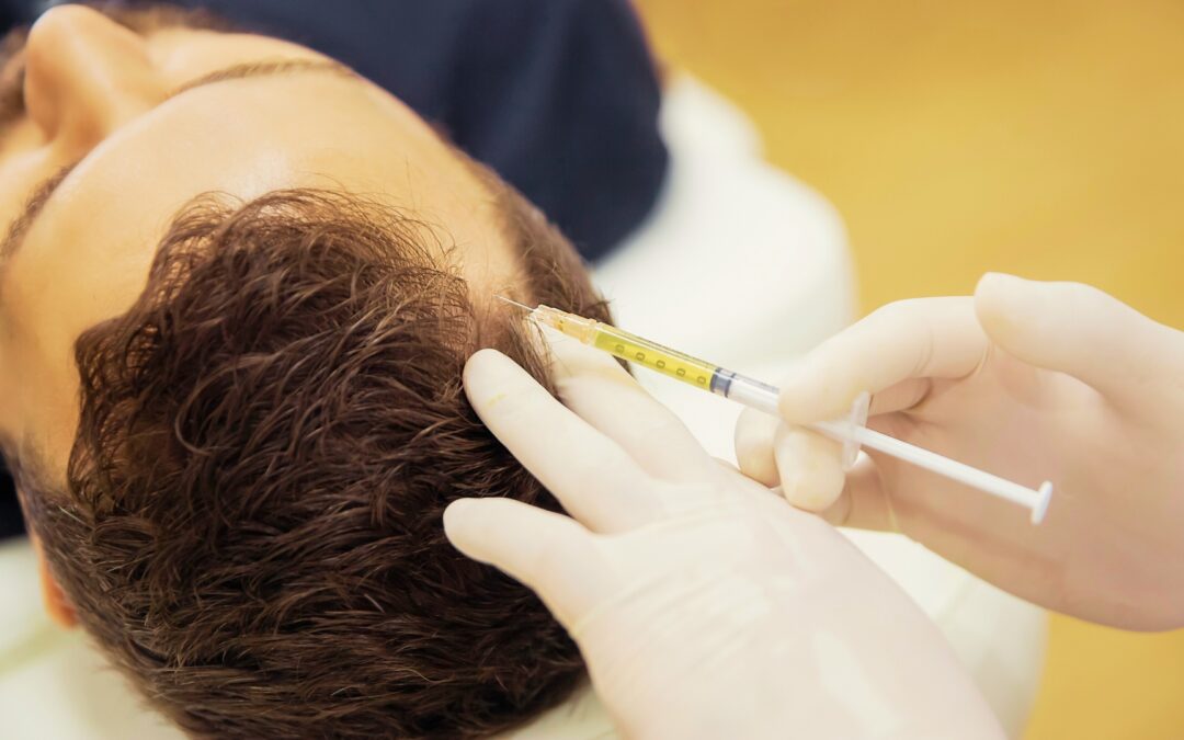 How Much Does PRP for Hair Cost in the UK?